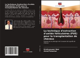 La technique d'extraction d'unités folliculaires (FUE) pour la transplantation de cheveux