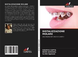 DISTALIZZAZIONE MOLARE