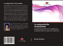 La polyarthrite rhumatoïde