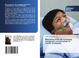 Mucormycosis: An emerging dangerous complication of Covid-19 disease