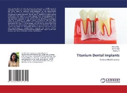 TITANIUM DENTAL IMPLANTS