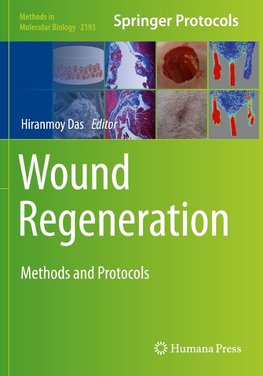 Wound Regeneration