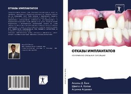 OTKAZY IMPLANTATOV