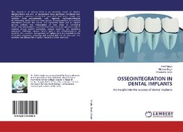 OSSEOINTEGRATION IN DENTAL IMPLANTS