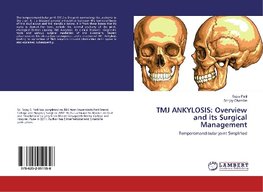 TMJ ANKYLOSIS: Overview and its Surgical Management