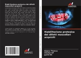 Riabilitazione protesica dei difetti mascellari acquisiti