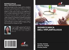 BIOMECCANICA DELL'IMPLANTOLOGIA