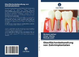 Oberflächenbehandlung von Zahnimplantaten