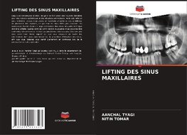 LIFTING DES SINUS MAXILLAIRES