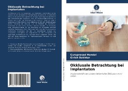 Okklusale Betrachtung bei Implantaten