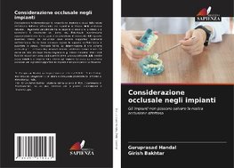 Considerazione occlusale negli impianti