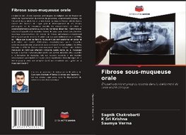 Fibrose sous-muqueuse orale