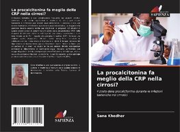 La procalcitonina fa meglio della CRP nella cirrosi?