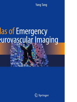 Atlas of Emergency Neurovascular Imaging