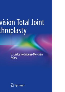 Revision Total Joint Arthroplasty