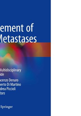 Management of Bone Metastases