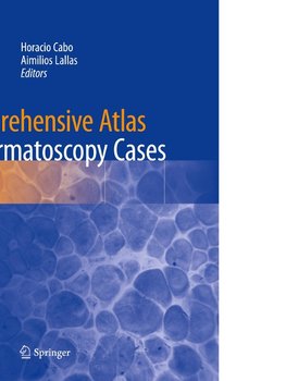 Comprehensive Atlas of Dermatoscopy Cases