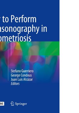 How to Perform Ultrasonography in Endometriosis