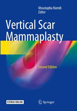 Vertical Scar Mammaplasty