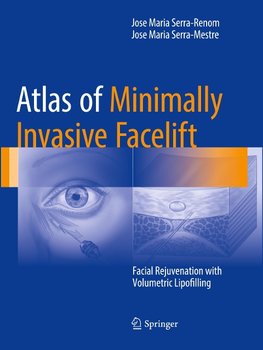 Atlas of Minimally Invasive Facelift