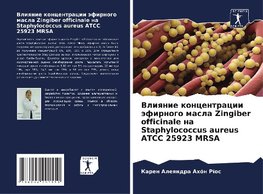 Vliqnie koncentracii äfirnogo masla Zingiber officinale na Staphylococcus aureus ATCC 25923 MRSA