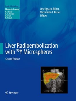 Liver Radioembolization with 90Y Microspheres