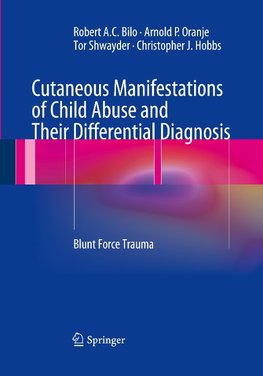 Cutaneous Manifestations of Child Abuse and Their Differential Diagnosis