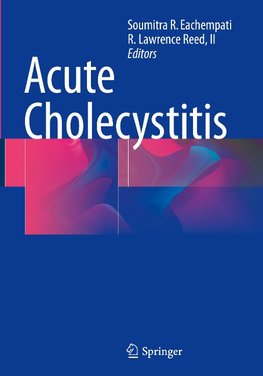 Acute Cholecystitis