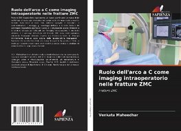 Ruolo dell'arco a C come imaging intraoperatorio nelle fratture ZMC