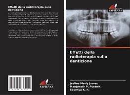 Effetti della radioterapia sulla dentizione