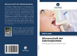 Wissenschaft der Zahnimplantate