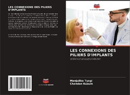 LES CONNEXIONS DES PILIERS D'IMPLANTS