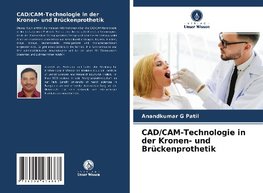 CAD/CAM-Technologie in der Kronen- und Brückenprothetik