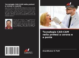 Tecnologia CAD-CAM nella protesi a corona e a ponte