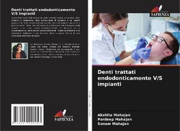 Denti trattati endodonticamente V/S impianti