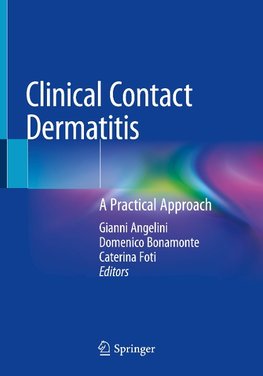 Clinical Contact Dermatitis