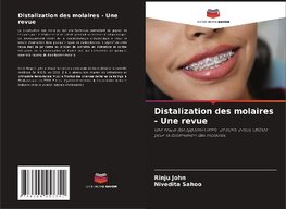 Distalization des molaires - Une revue