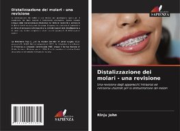 Distalizzazione dei molari - una revisione