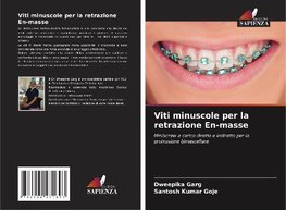 Viti minuscole per la retrazione En-masse