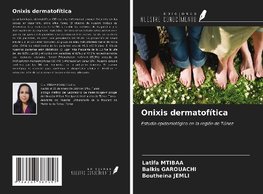 Onixis dermatofítica