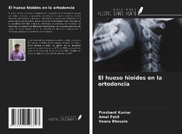 El hueso hioides en la ortodoncia