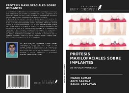 PRÓTESIS MAXILOFACIALES SOBRE IMPLANTES