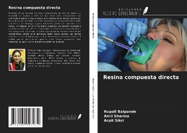 Resina compuesta directa