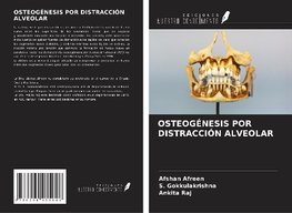 OSTEOGÉNESIS POR DISTRACCIÓN ALVEOLAR