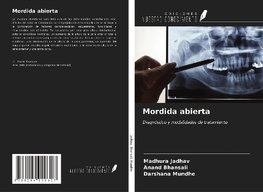 Mordida abierta