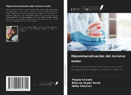 Hipomineralización del incisivo molar