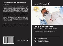 Cirugía periodontal mínimamente invasiva