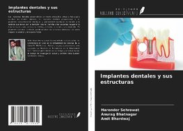 Implantes dentales y sus estructuras