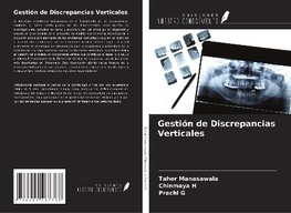 Gestión de Discrepancias Verticales