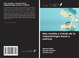 Una revista a través de la implantología basal y cortical